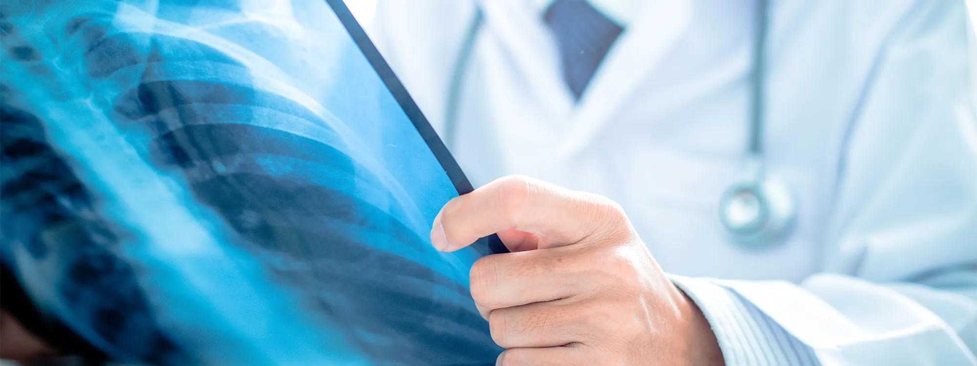 Radiologie Sint-Amandsberg Gent - Radiologisch centrum voor echografie, mammografie en röntgen in 9040 Sint-Amandsberg